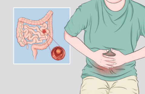 ���Ԥ����Ϣ�⣿���ͺ��ض���س�ҽԺ���⼸��򵥺üǣ�����������